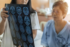 Traumatic Brain Injuries in the Elderly